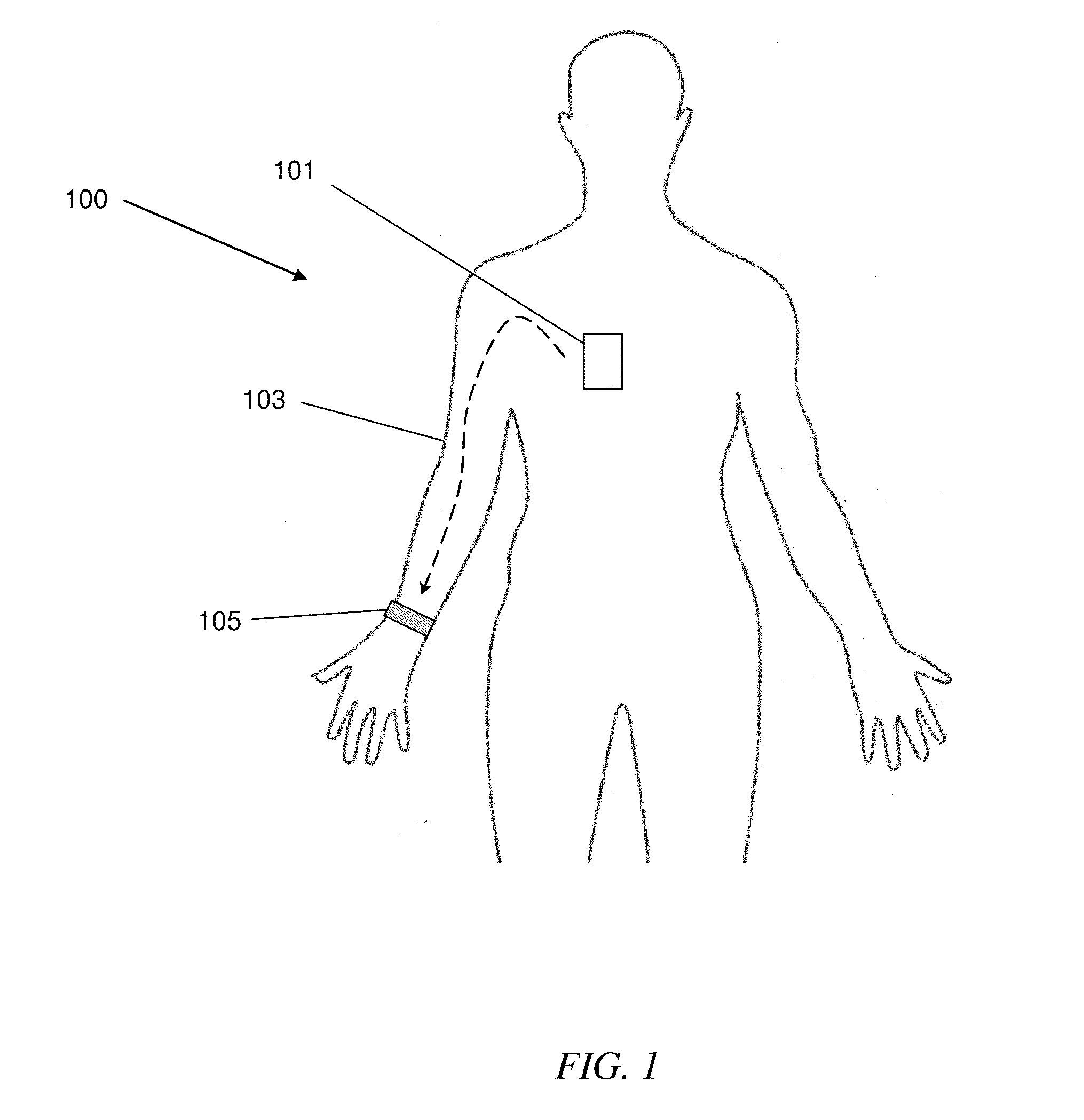 System and method for intra-body communication