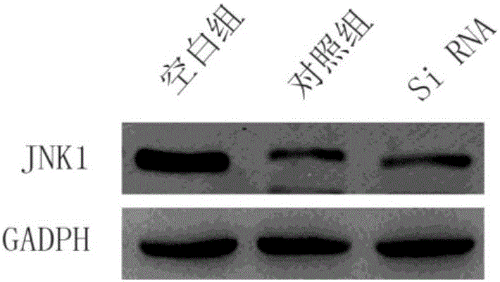 Human JNK1 (c-Jun N-terminal kinase) gene targeting small interfering RNA (ribonucleic acid) and application thereof