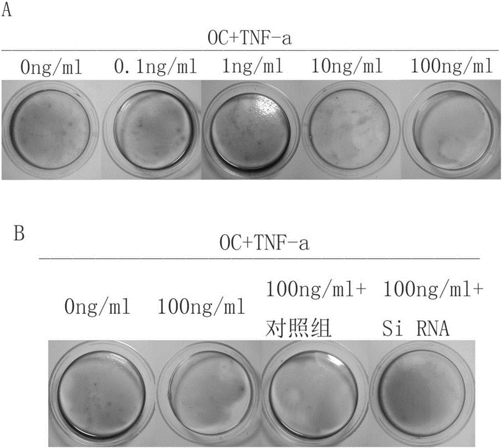 Human JNK1 (c-Jun N-terminal kinase) gene targeting small interfering RNA (ribonucleic acid) and application thereof