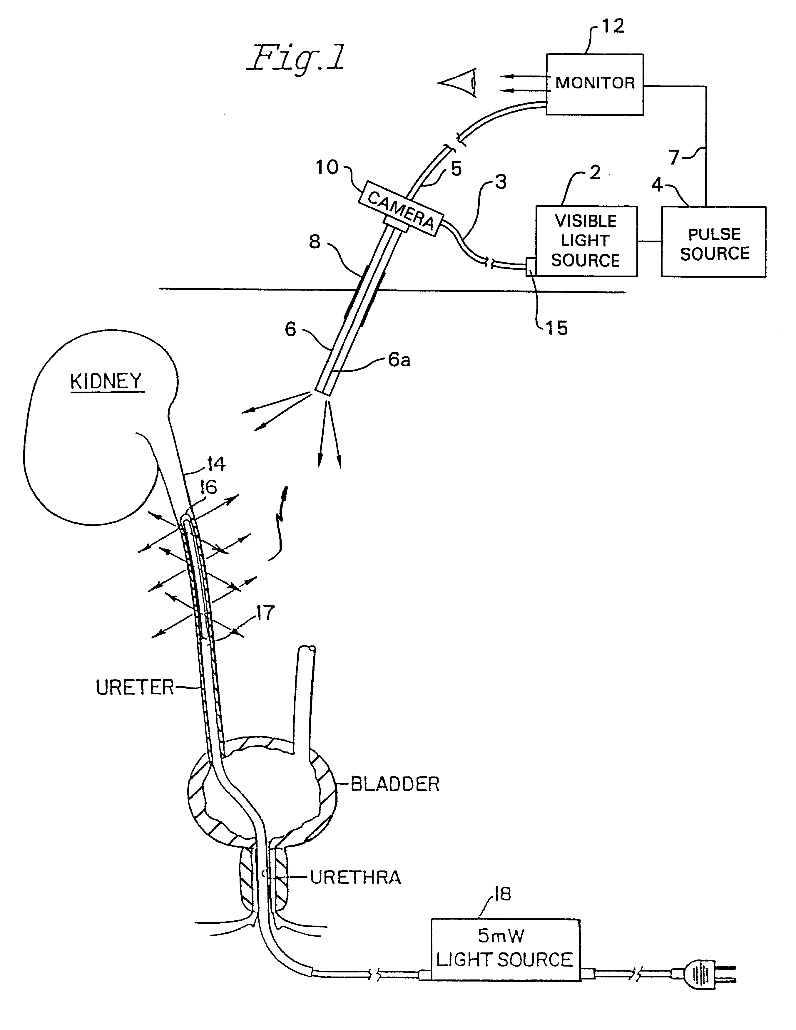 Transillumination of body members for protection during body invasive procedures