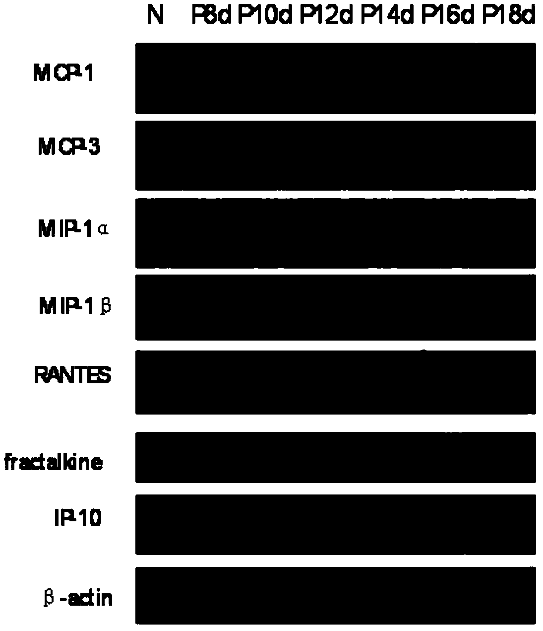 Application of met-RANTES in preparing medicine used for treating inherited retinal degeneration