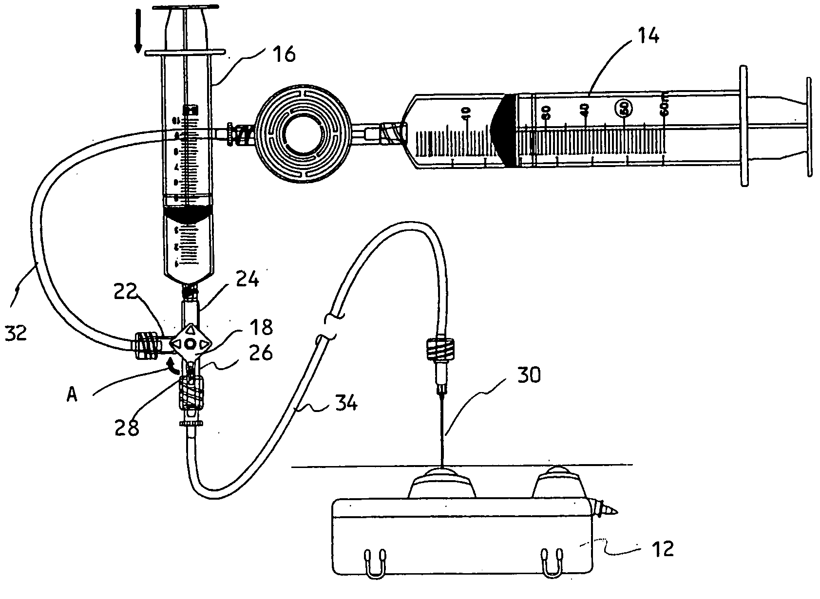 Refill kit for an implantable pump