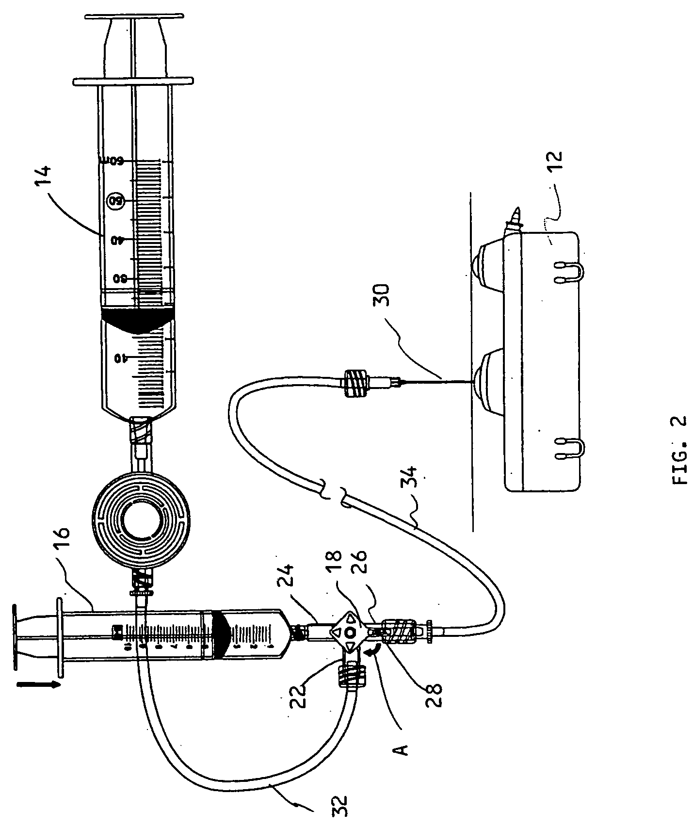 Refill kit for an implantable pump