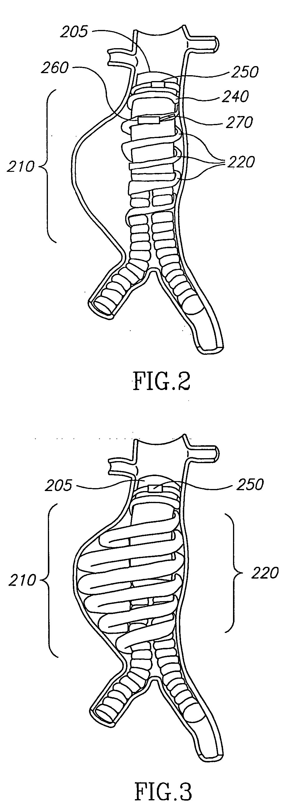 System and method of aneurism monitoring and treatment