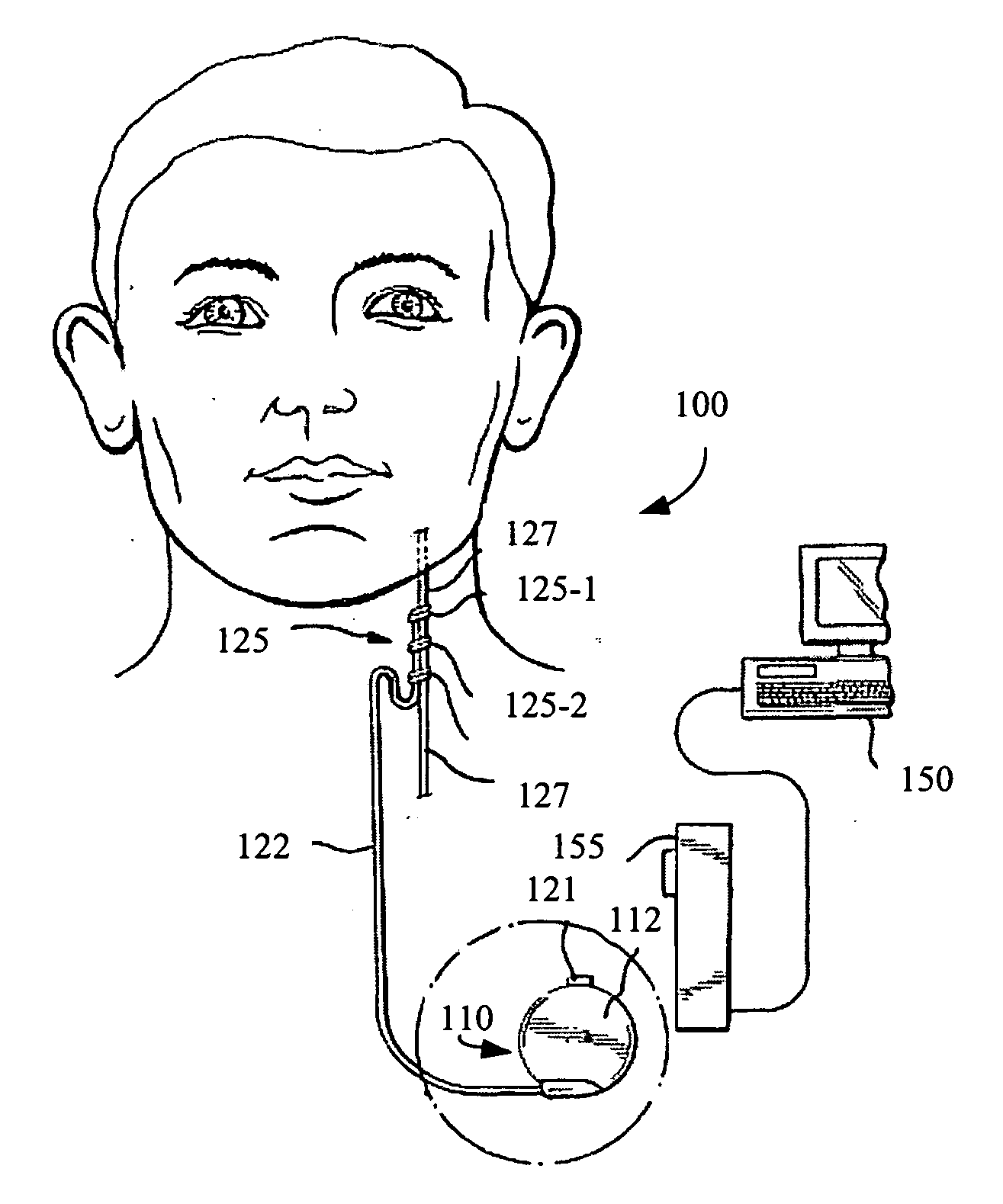 Method and apparatus for forming insulated implantable electrodes