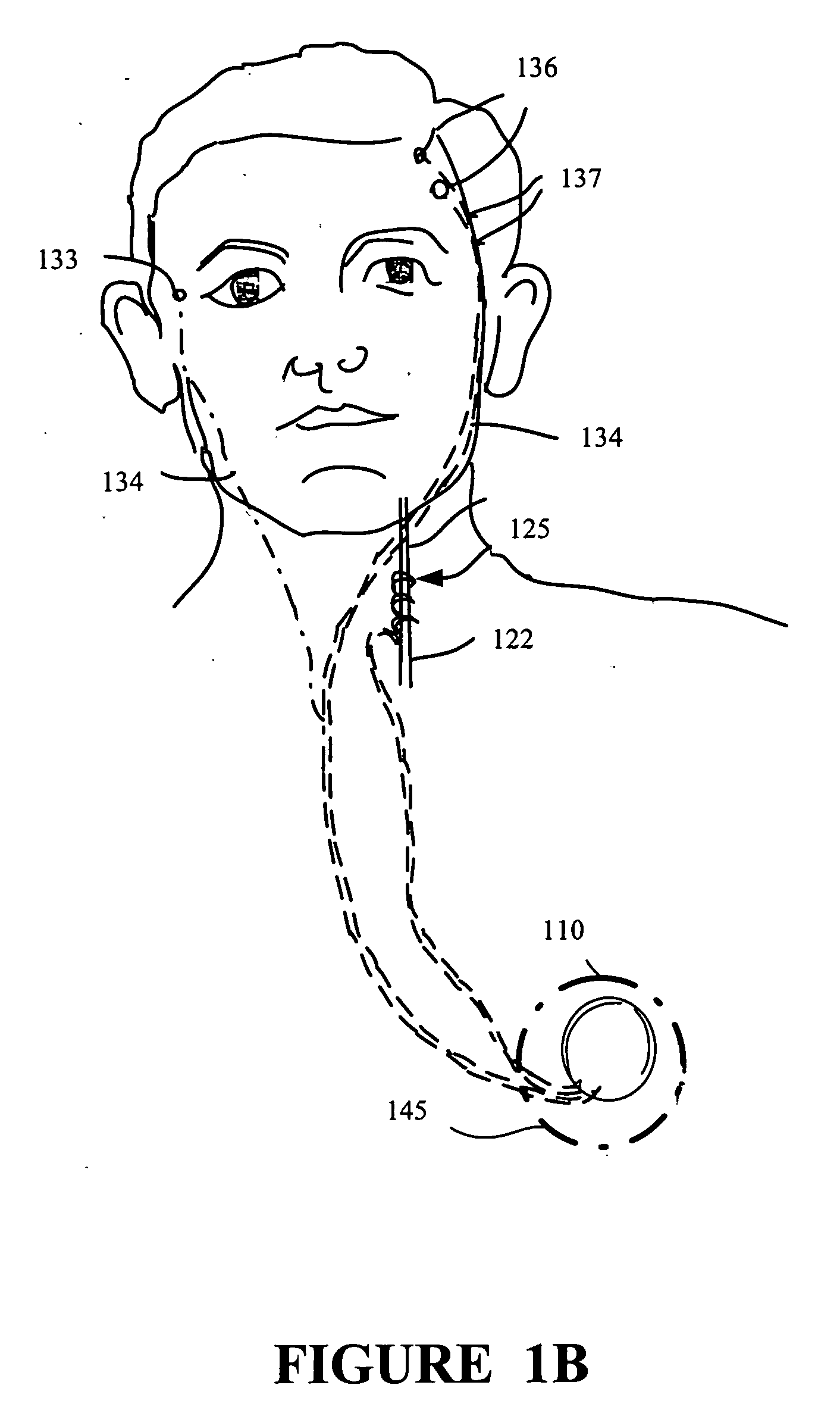 Method and apparatus for forming insulated implantable electrodes