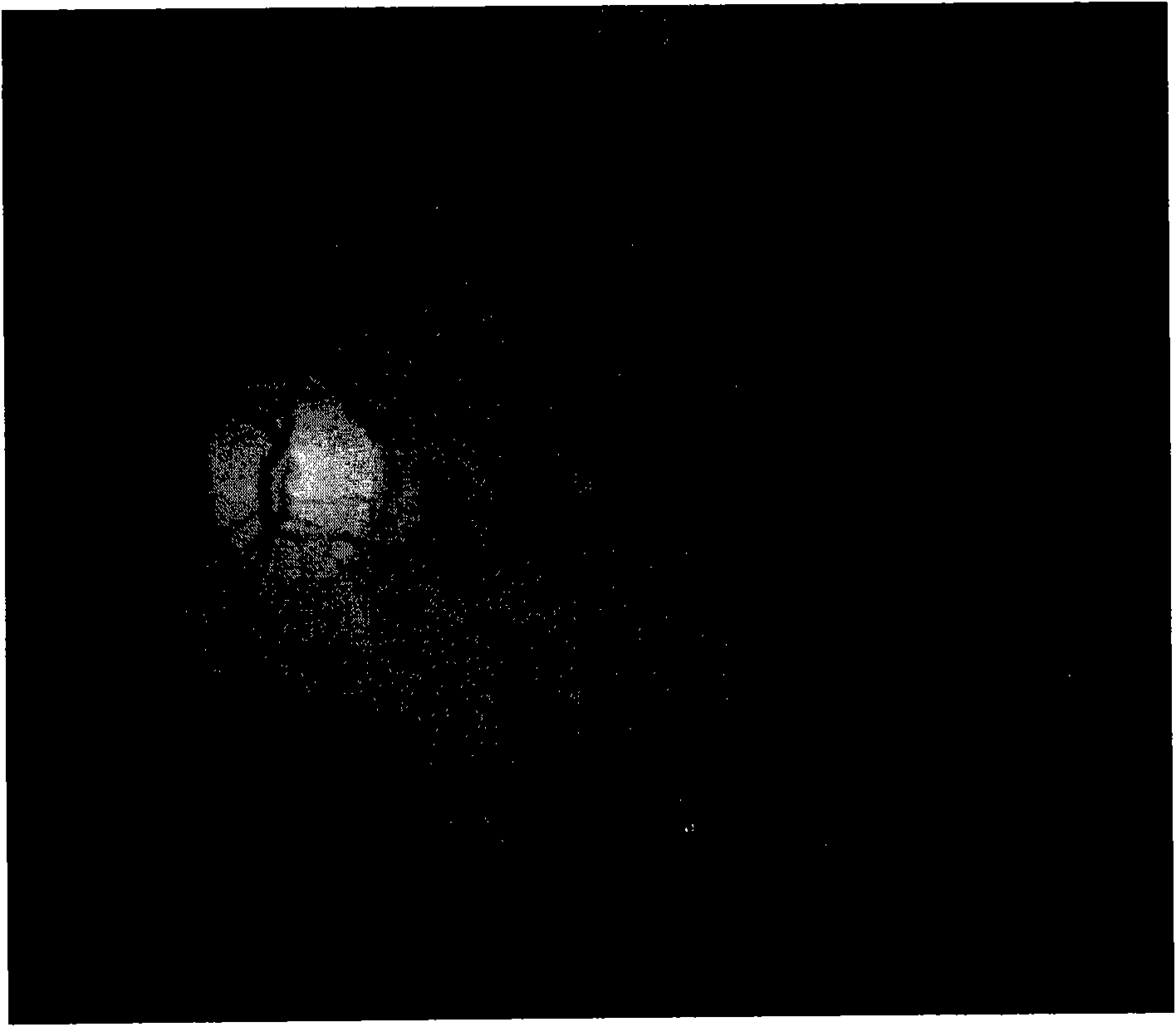 Ocular fundus image registration method estimated based on distance transformation parameter and rigid transformation parameter