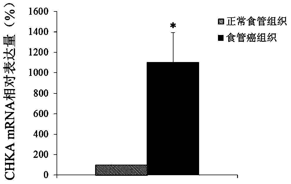 Application of chka gene in preparation of products for diagnosis and treatment of esophageal cancer