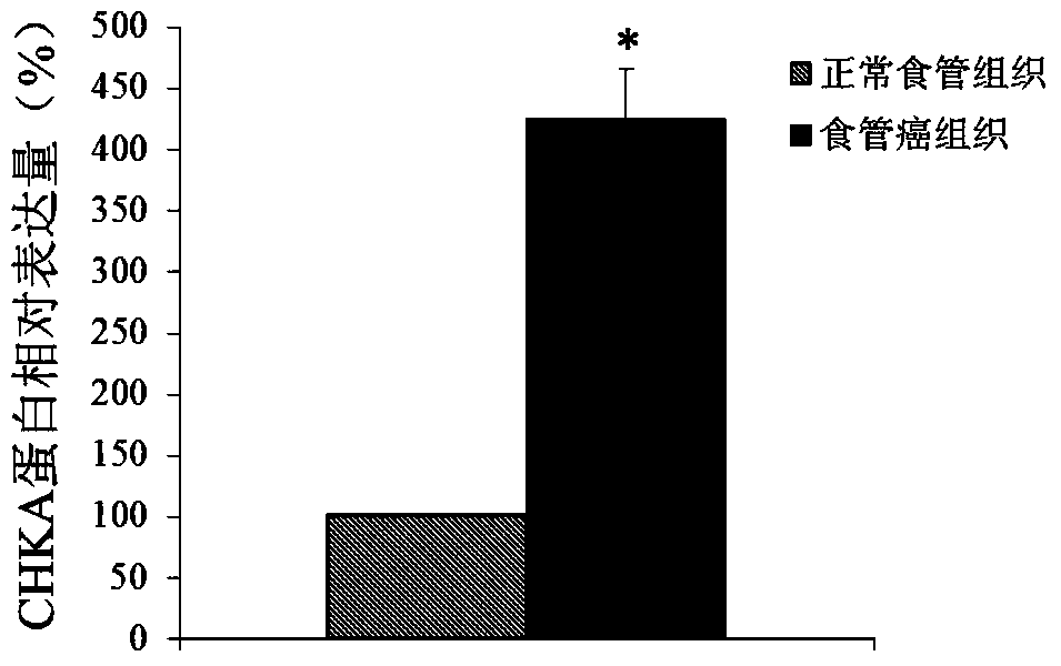 Application of chka gene in preparation of products for diagnosis and treatment of esophageal cancer