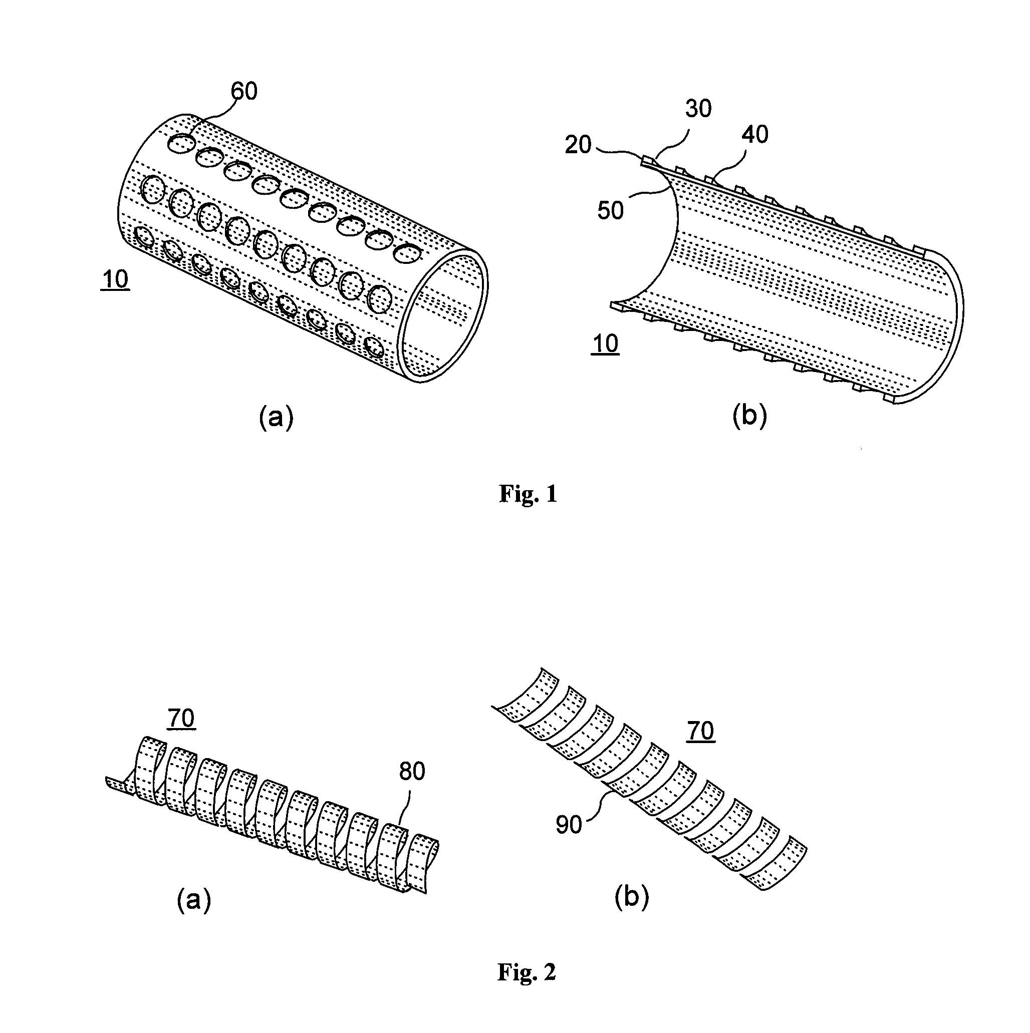 Porous implant structure