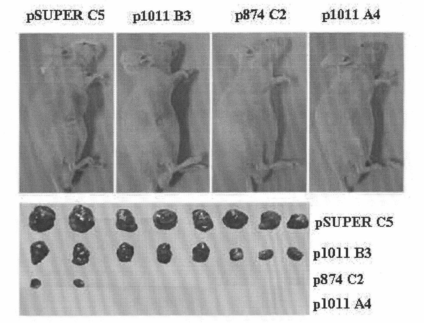 Ribonucleic acid taking liver cancer related gene DLK1 as target spot and application thereof