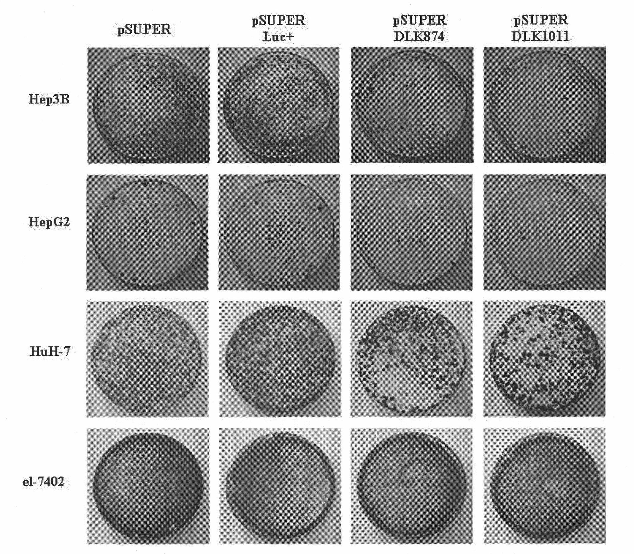 Ribonucleic acid taking liver cancer related gene DLK1 as target spot and application thereof