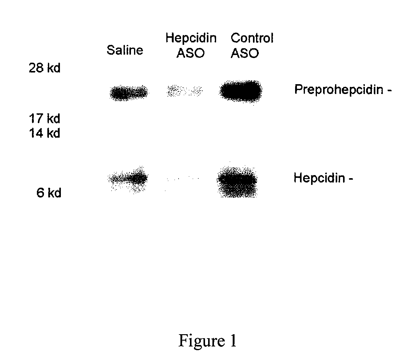 Compositions and their uses directed to hepcidin