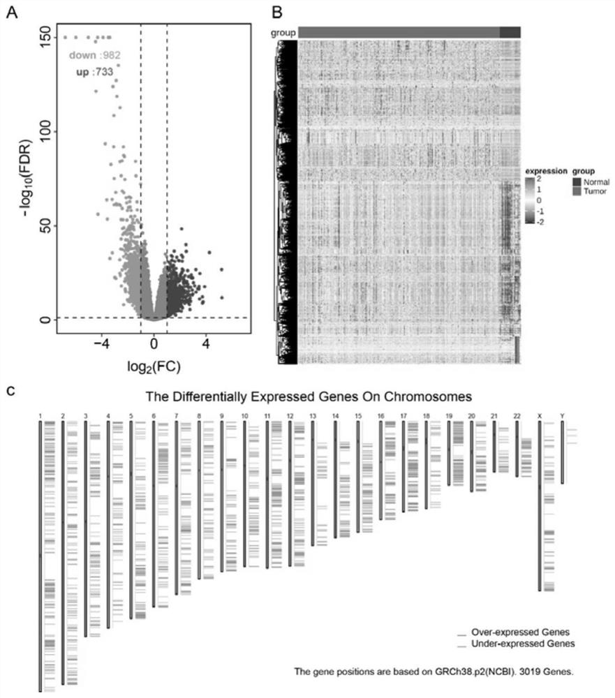 Potential antigen significantly related to prostate cancer, immune subtype, construction method and application thereof