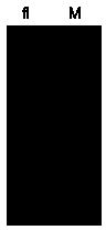 Method for expressing human IgE high affinity receptor protein in vitro