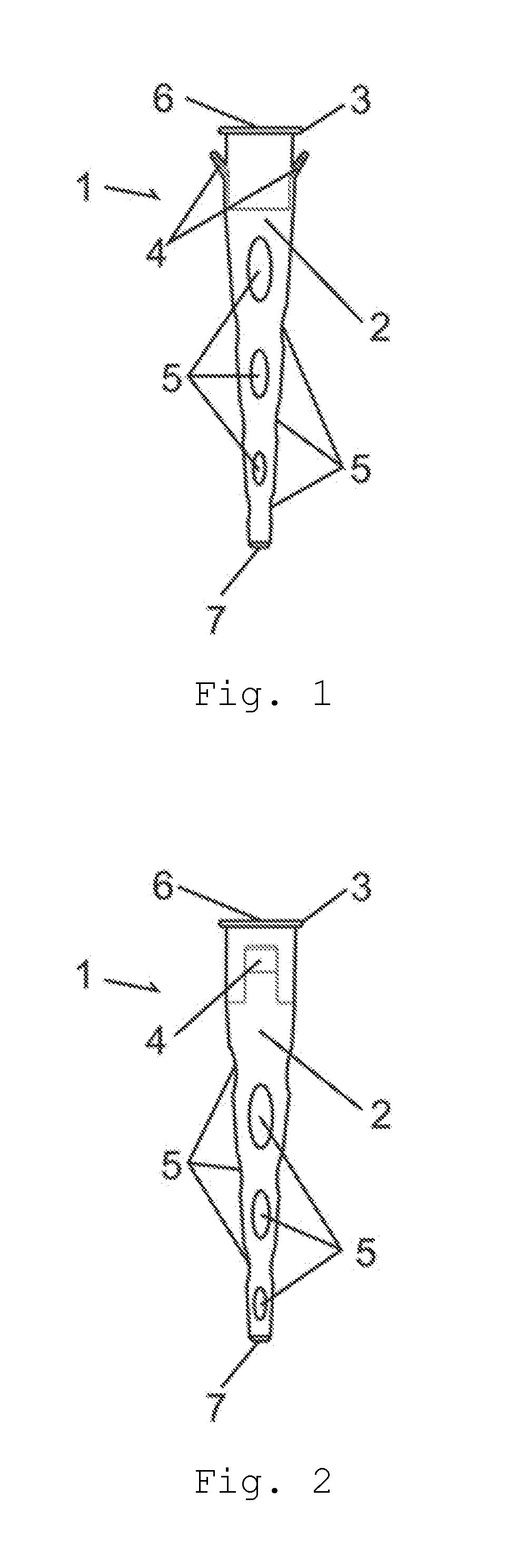 Artifical implantable bronchus