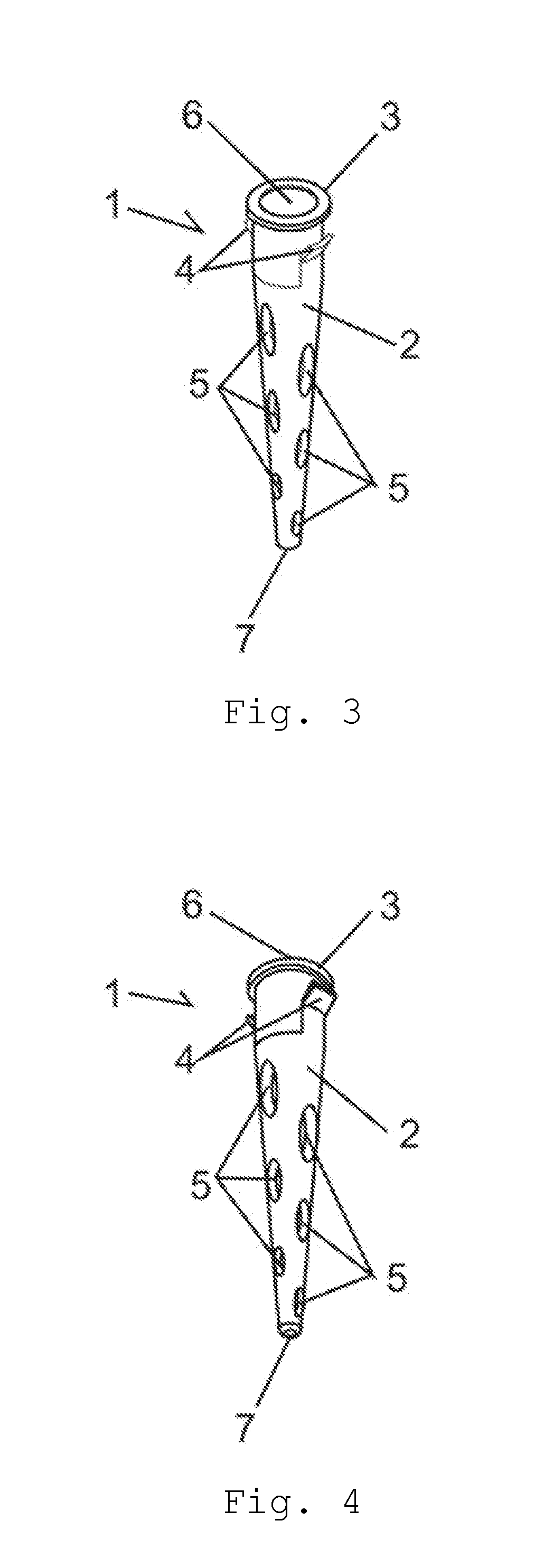 Artifical implantable bronchus