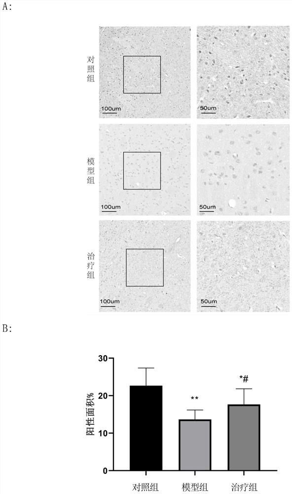 Application of peptide MOTS-c to preparation of medicine for treating Parkinson's disease