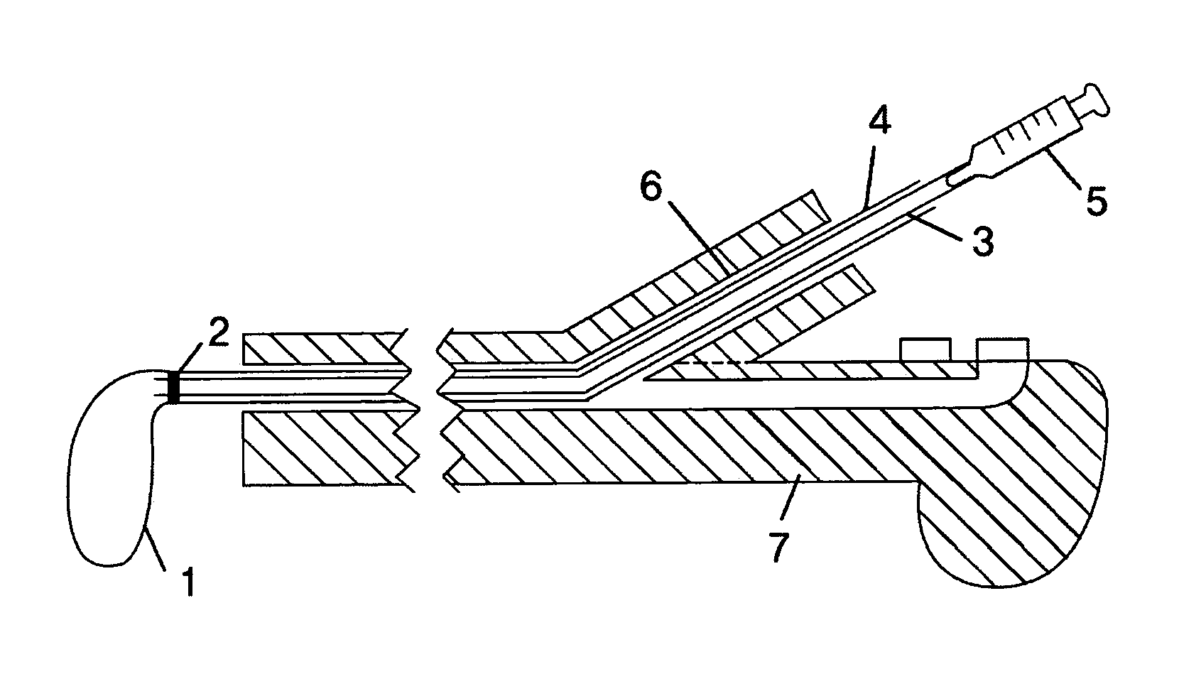 Endoscopic balloon insertion device for treatment of obesity and insertion technique of the same