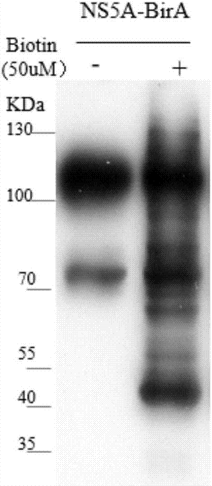 CD2 binding protein (CD2AP) and protein interacting therewith