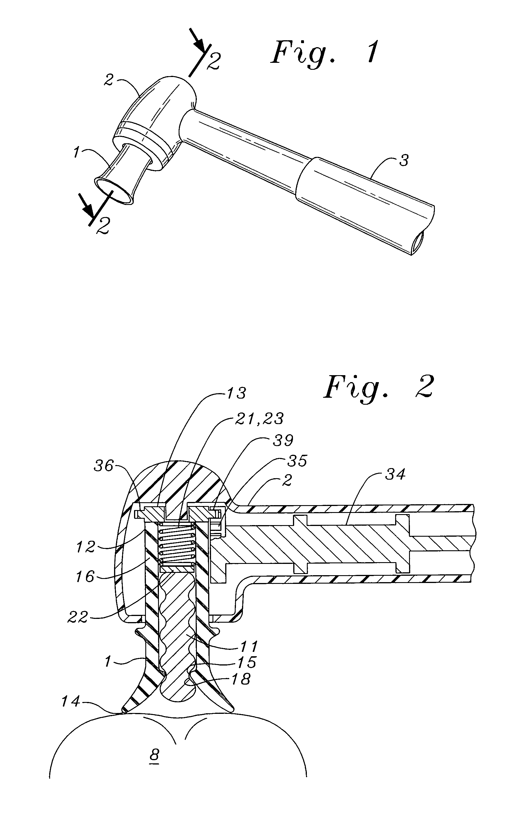 All-in-one prophy angle