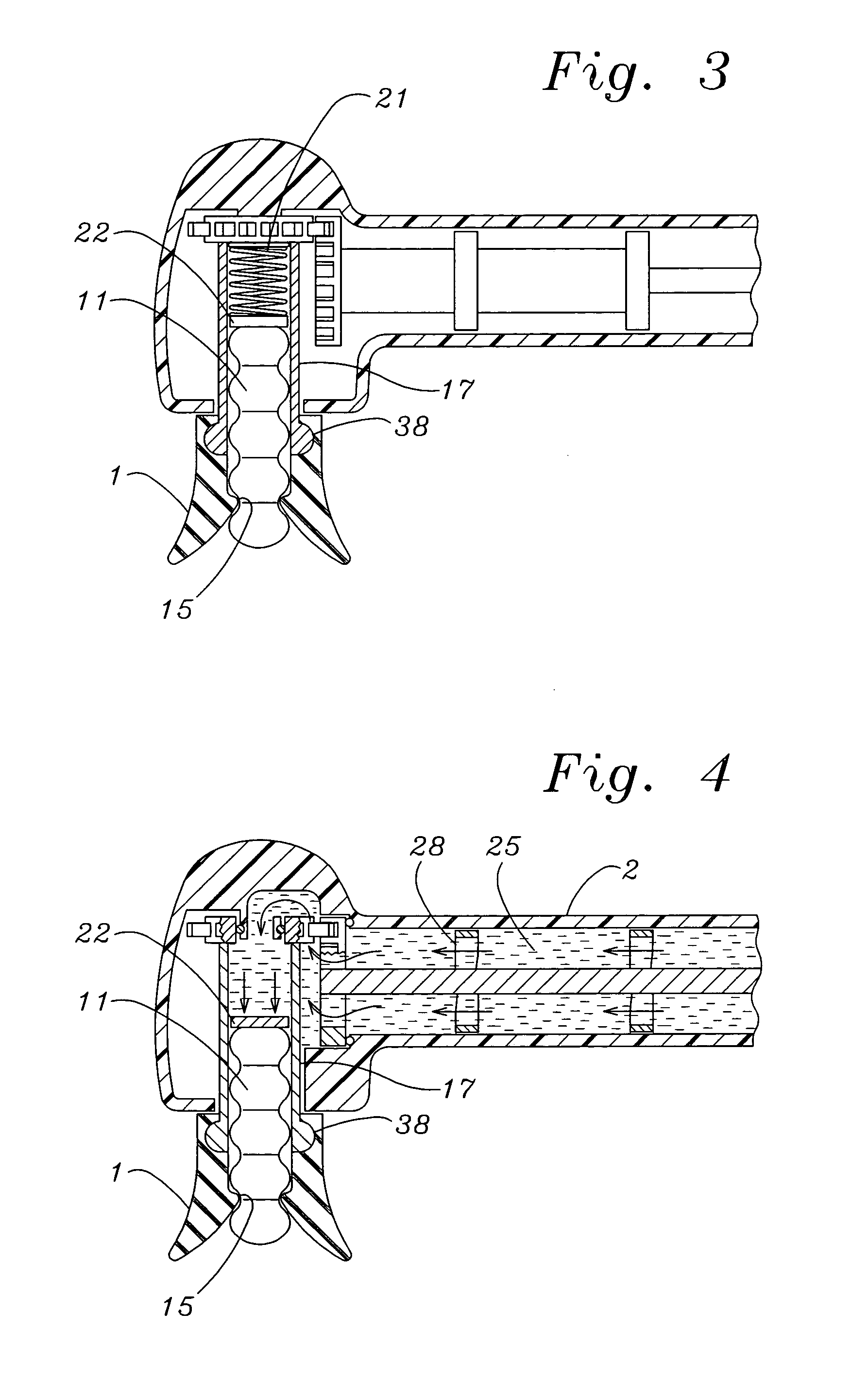 All-in-one prophy angle