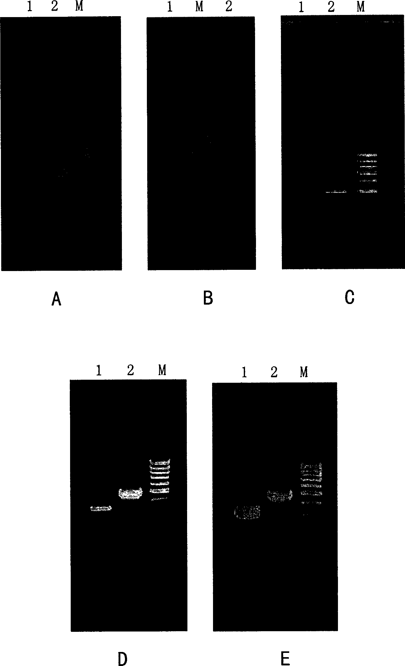 Fluorogenic quantitative PCR method for detecting gamma interferon gene expression in peripheral-blood under physiological state