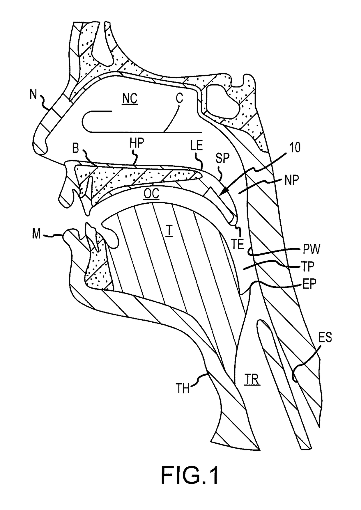 Bioadhesive Strip and Method of Using Same