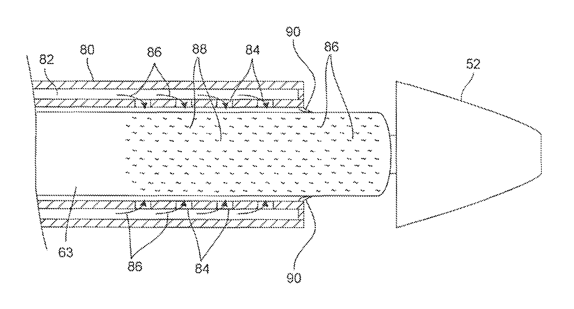 Adjustable-length drug delivery balloon