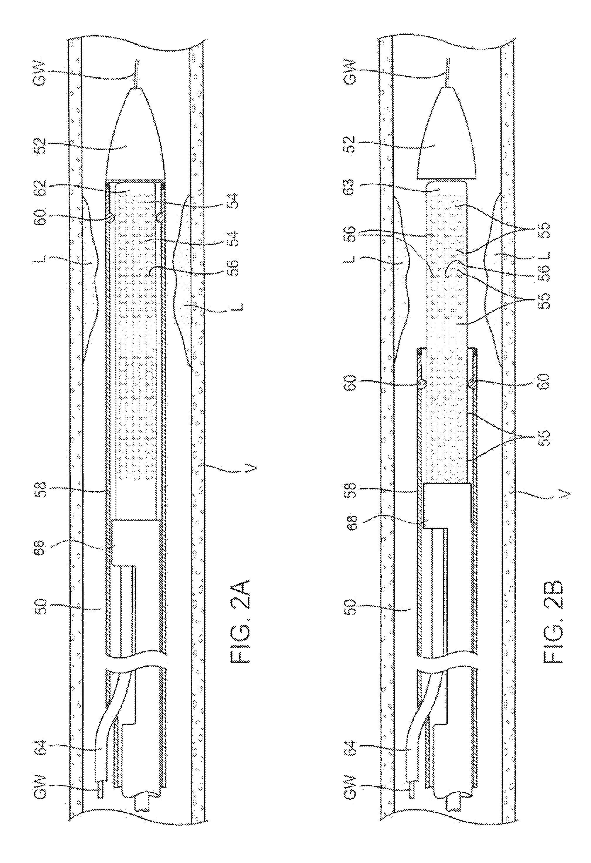 Adjustable-length drug delivery balloon