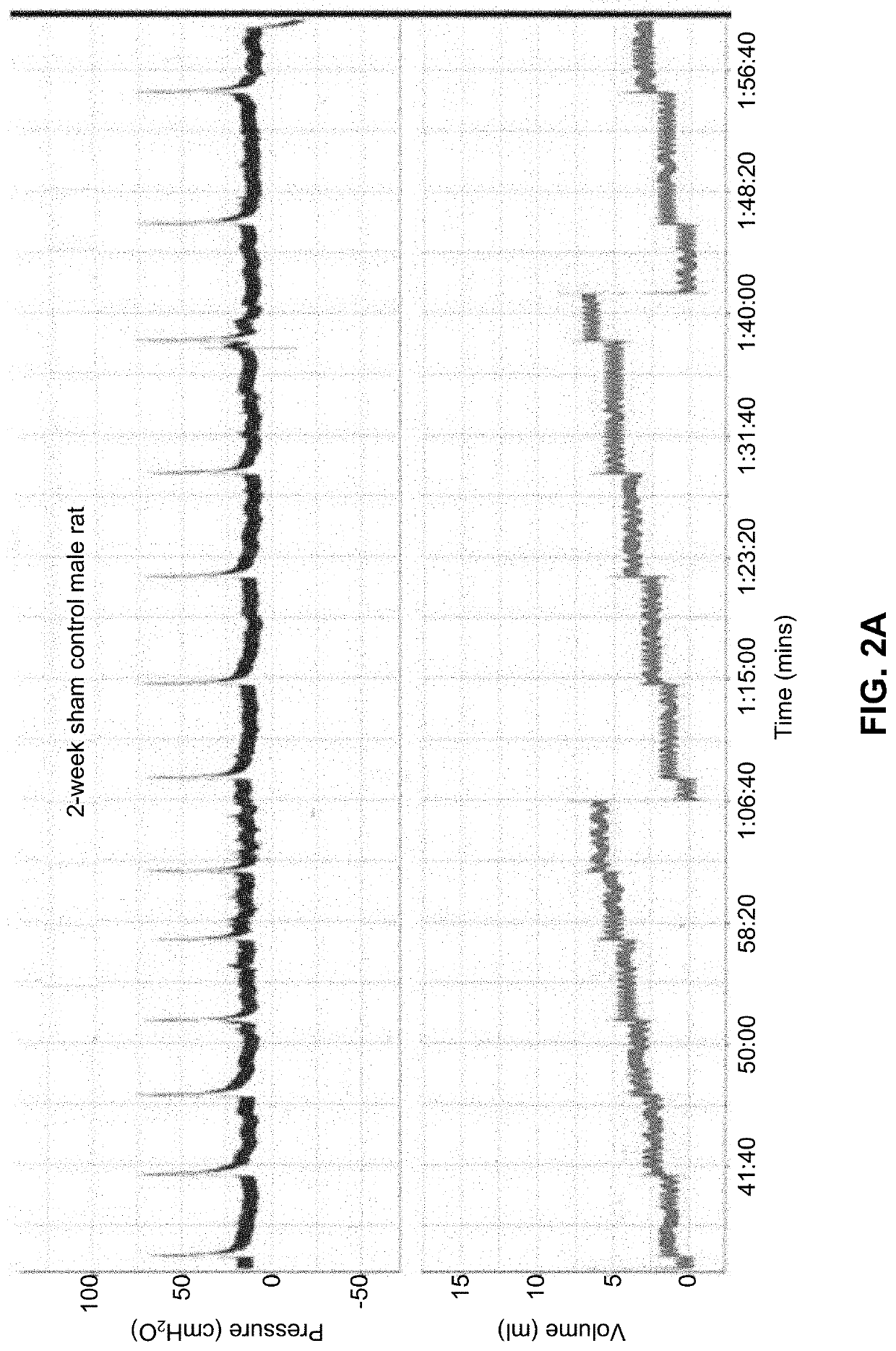 Compositions and methods for the treatment of smooth muscle dysfunction