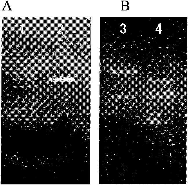 Protein derivatives of human granzyme B, and use thereof in targeted therapy on adenocarcinoma