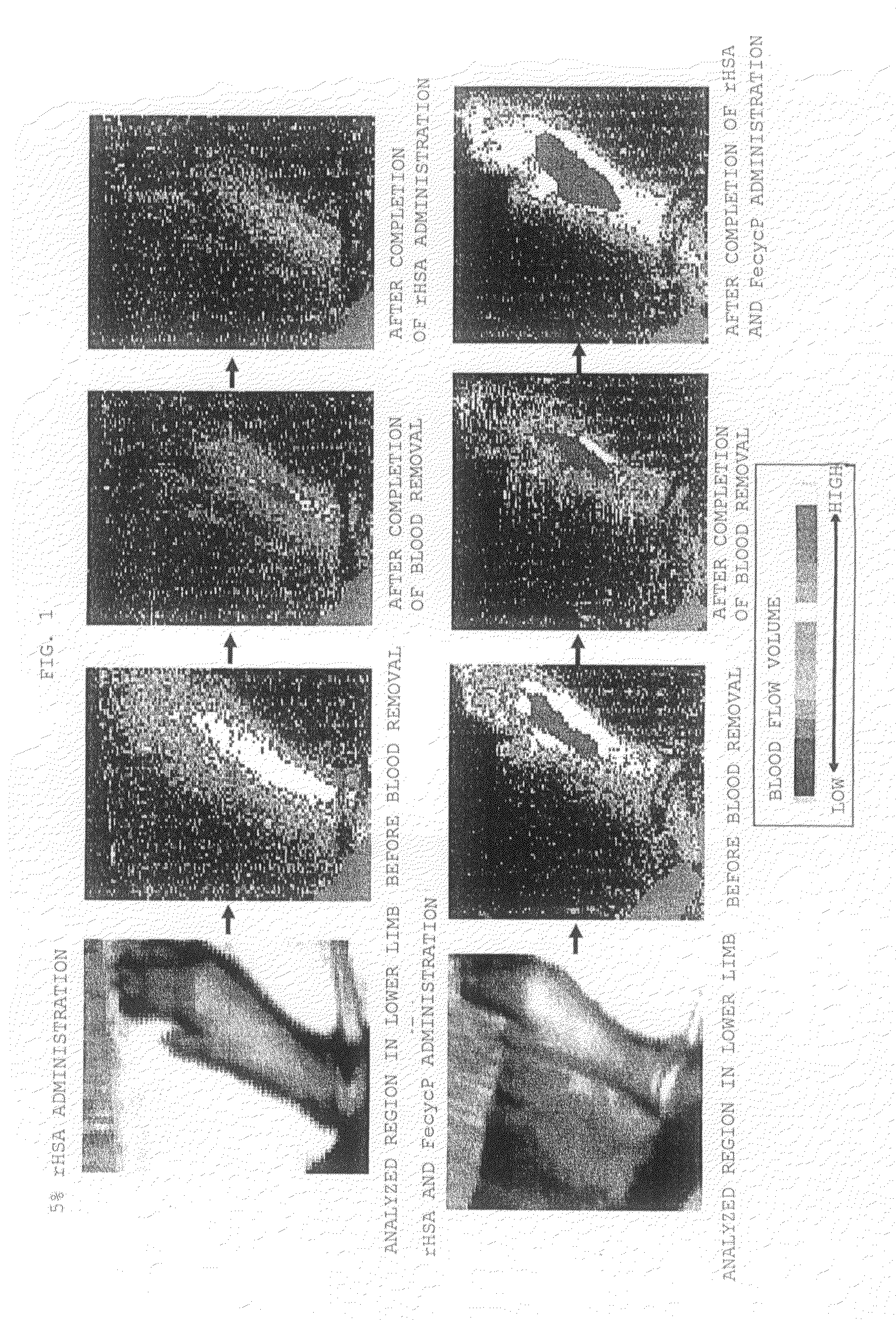 Agent for improving circulatory disorder