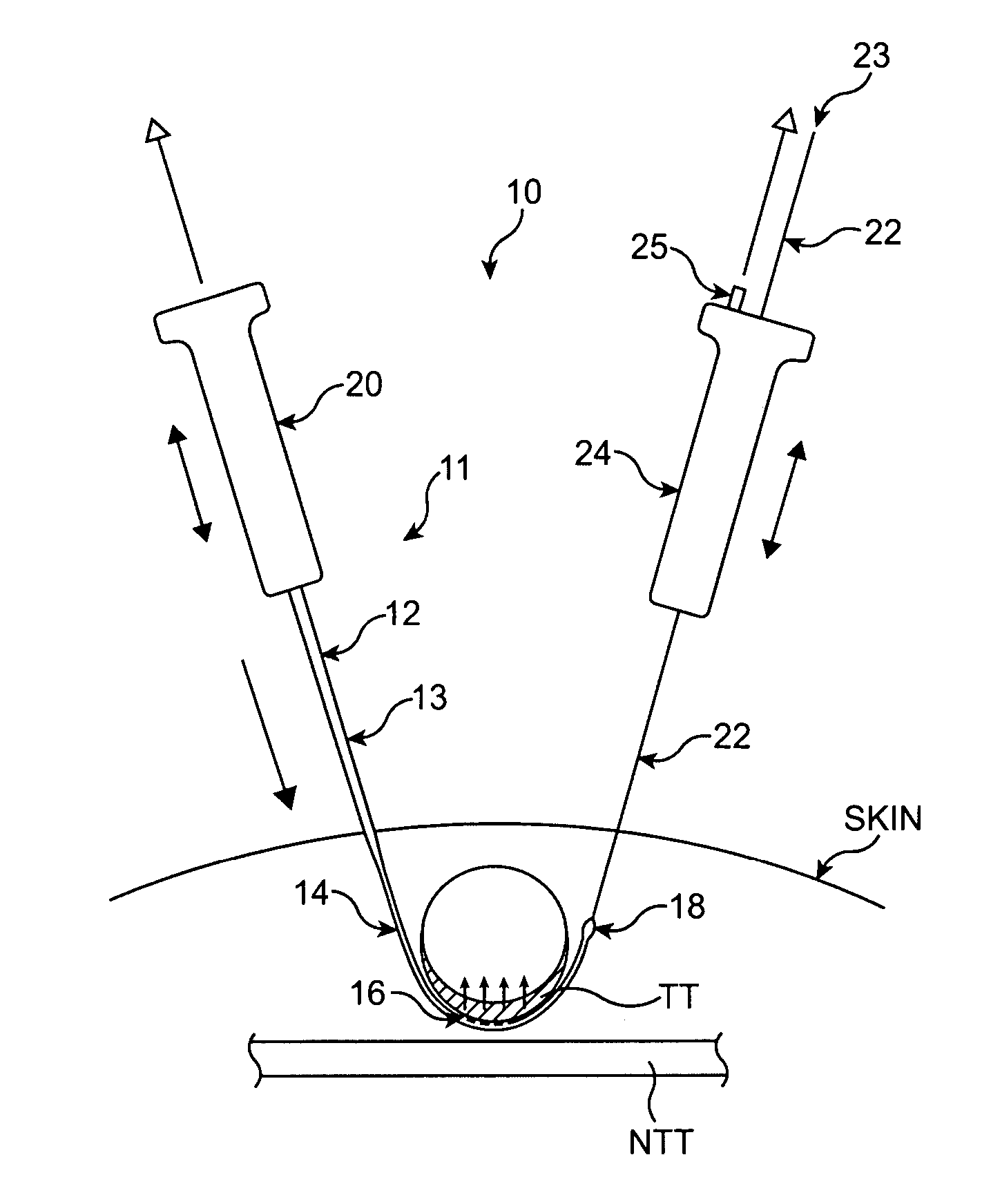 Tissue removal with at least partially flexible devices