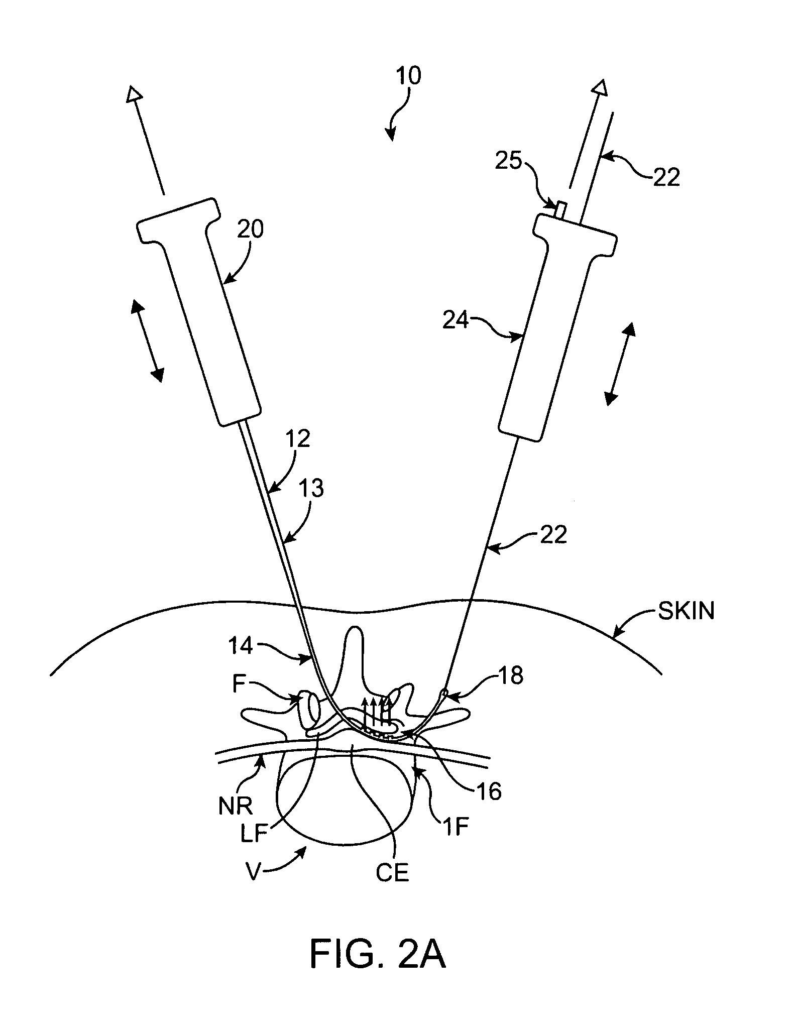 Tissue removal with at least partially flexible devices