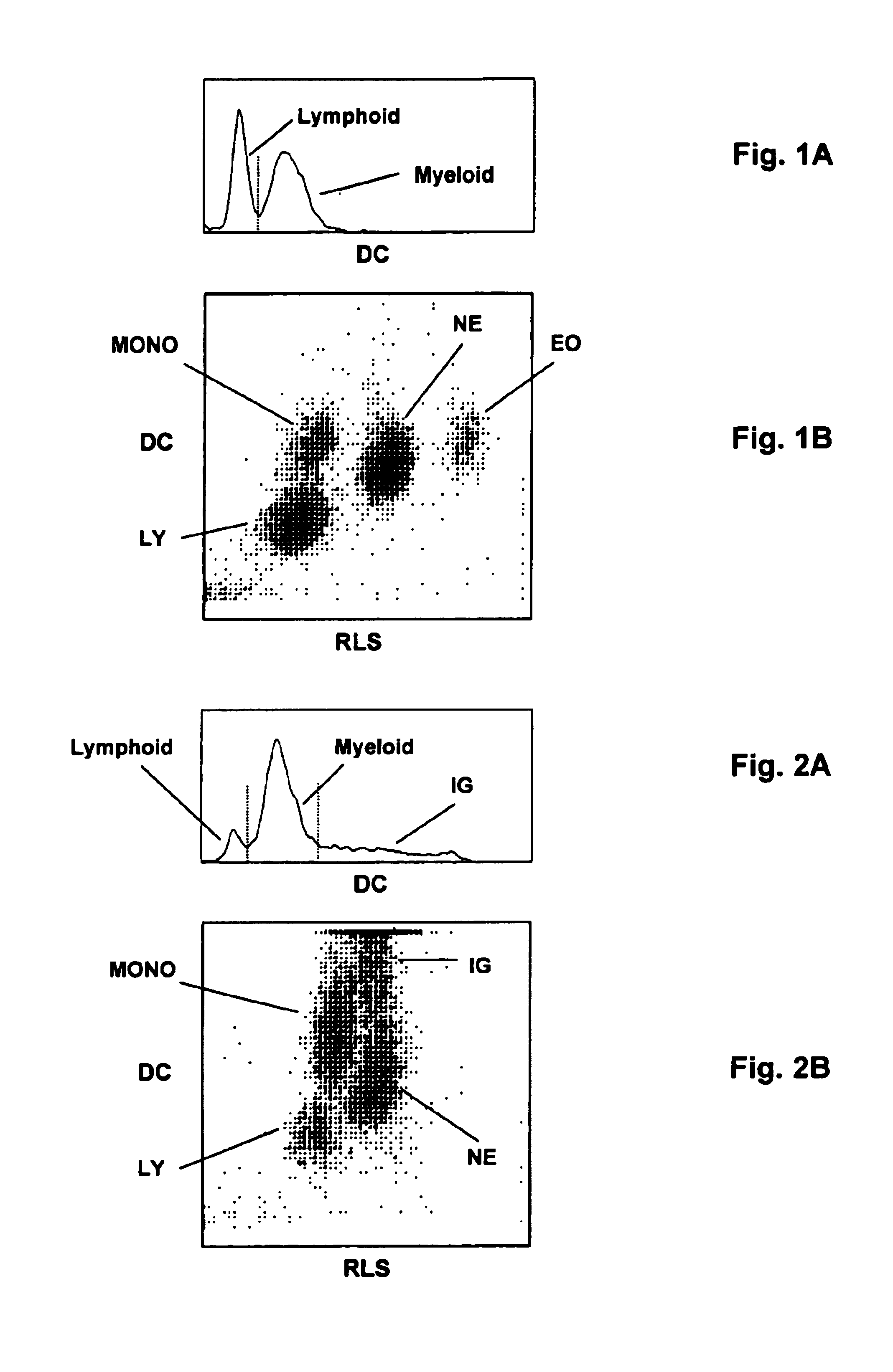 Method for measurement of immature granulocytes