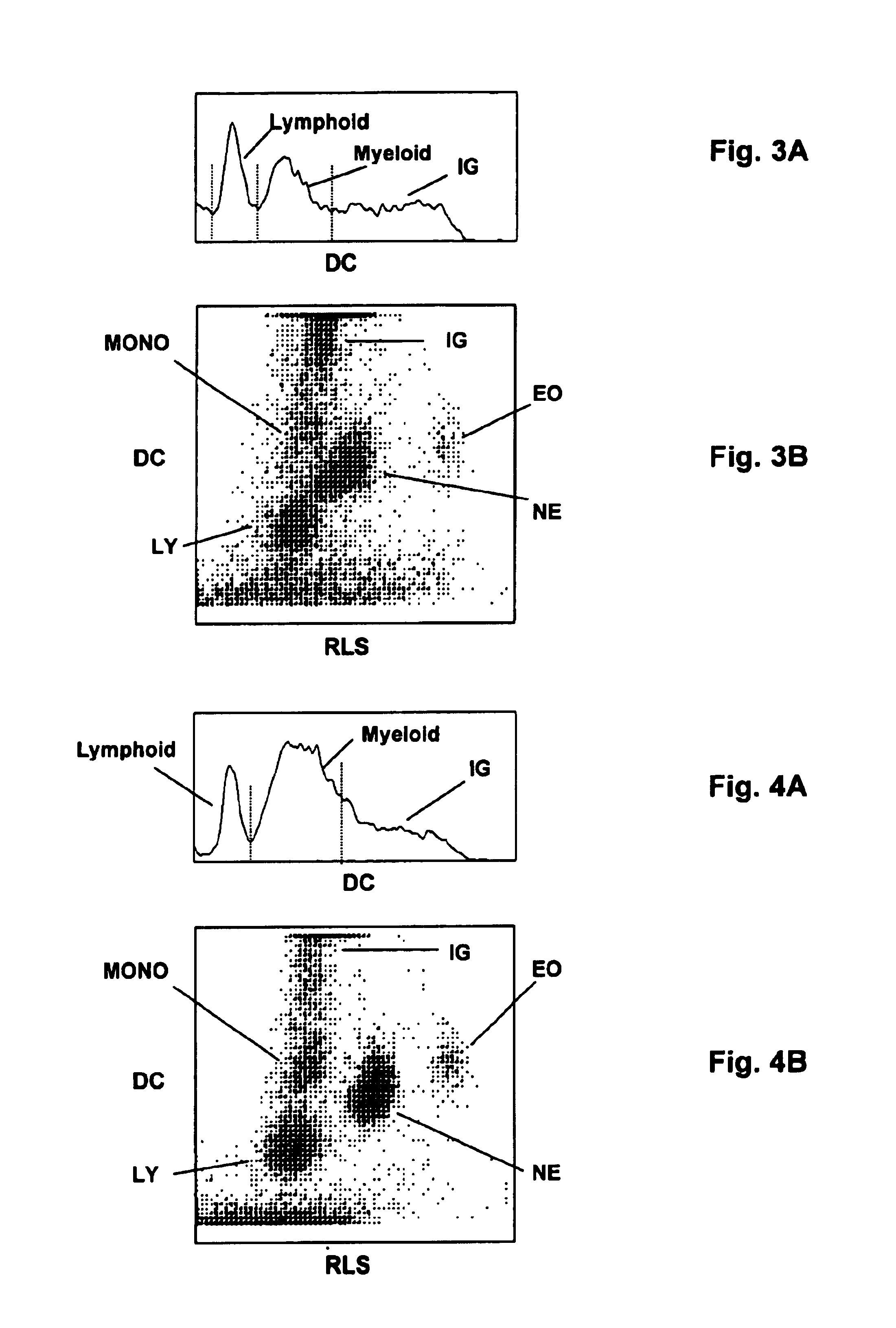 Method for measurement of immature granulocytes