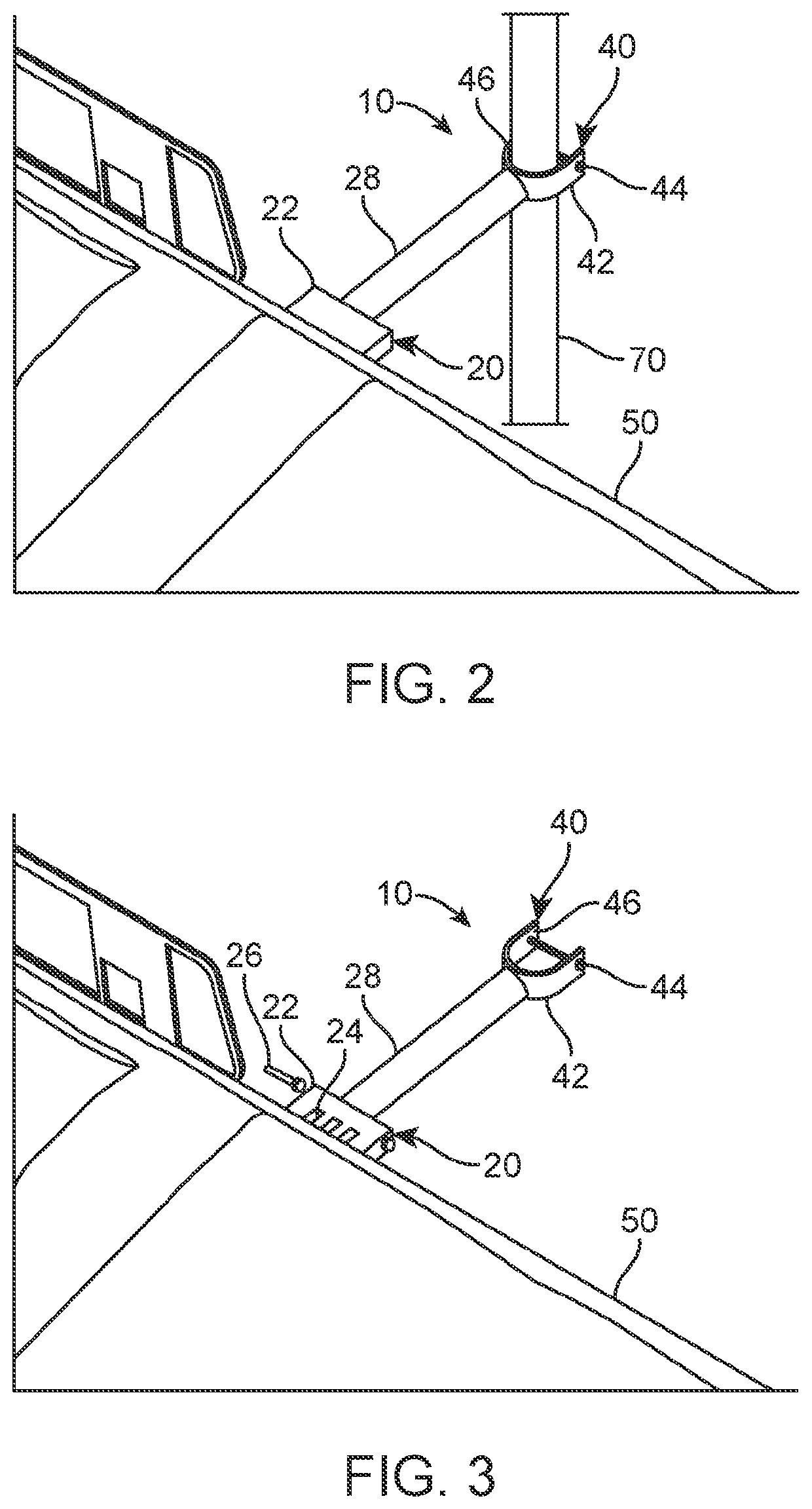 Medical equipment mounting system for an I.V. pole