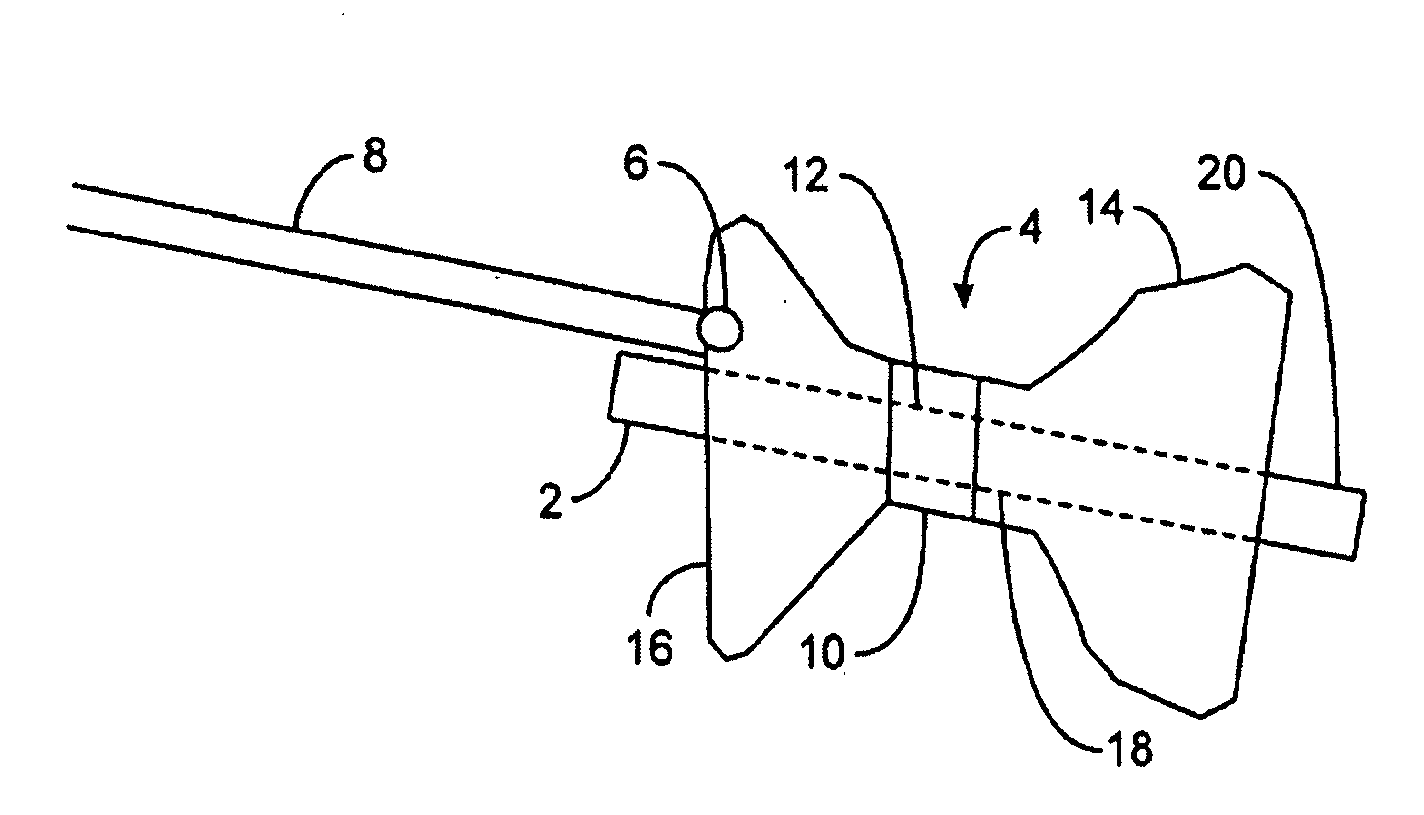 Gastric retaining devices and methods