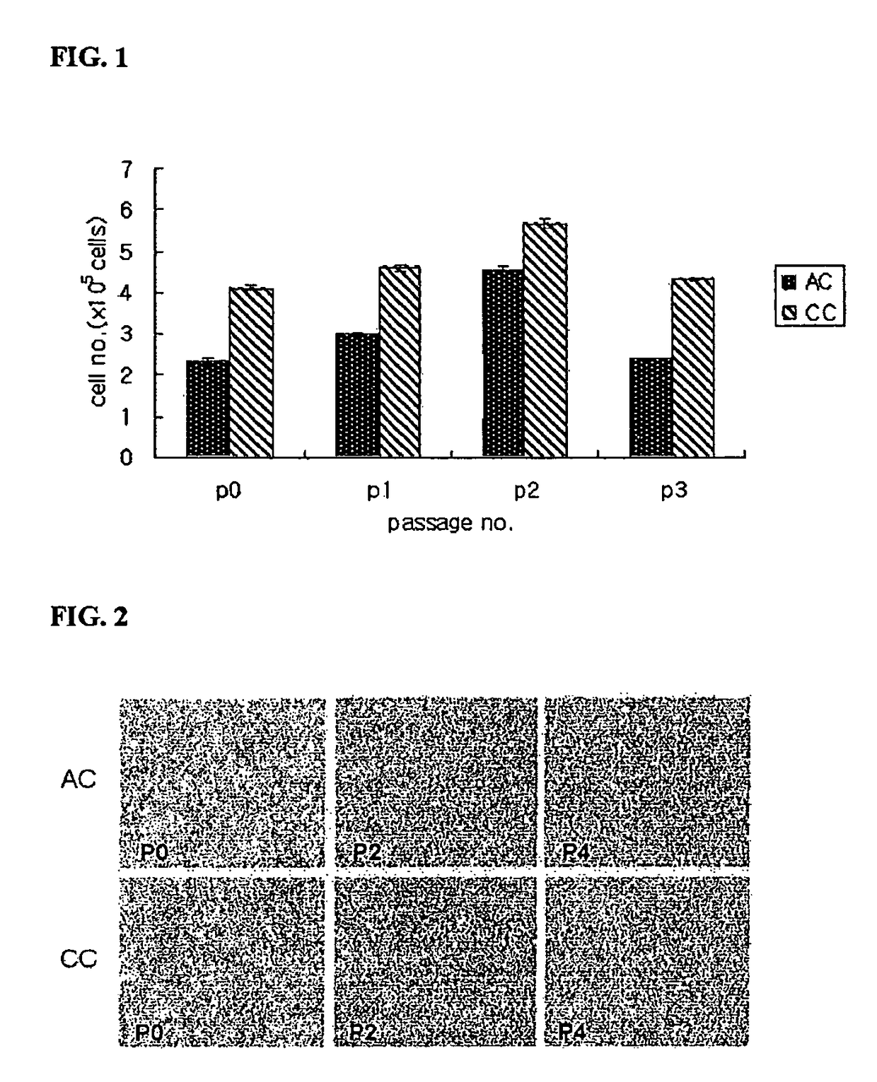 Artificial cartilage containing chondrocytes obtained from costal cartilage and preparation process thereof