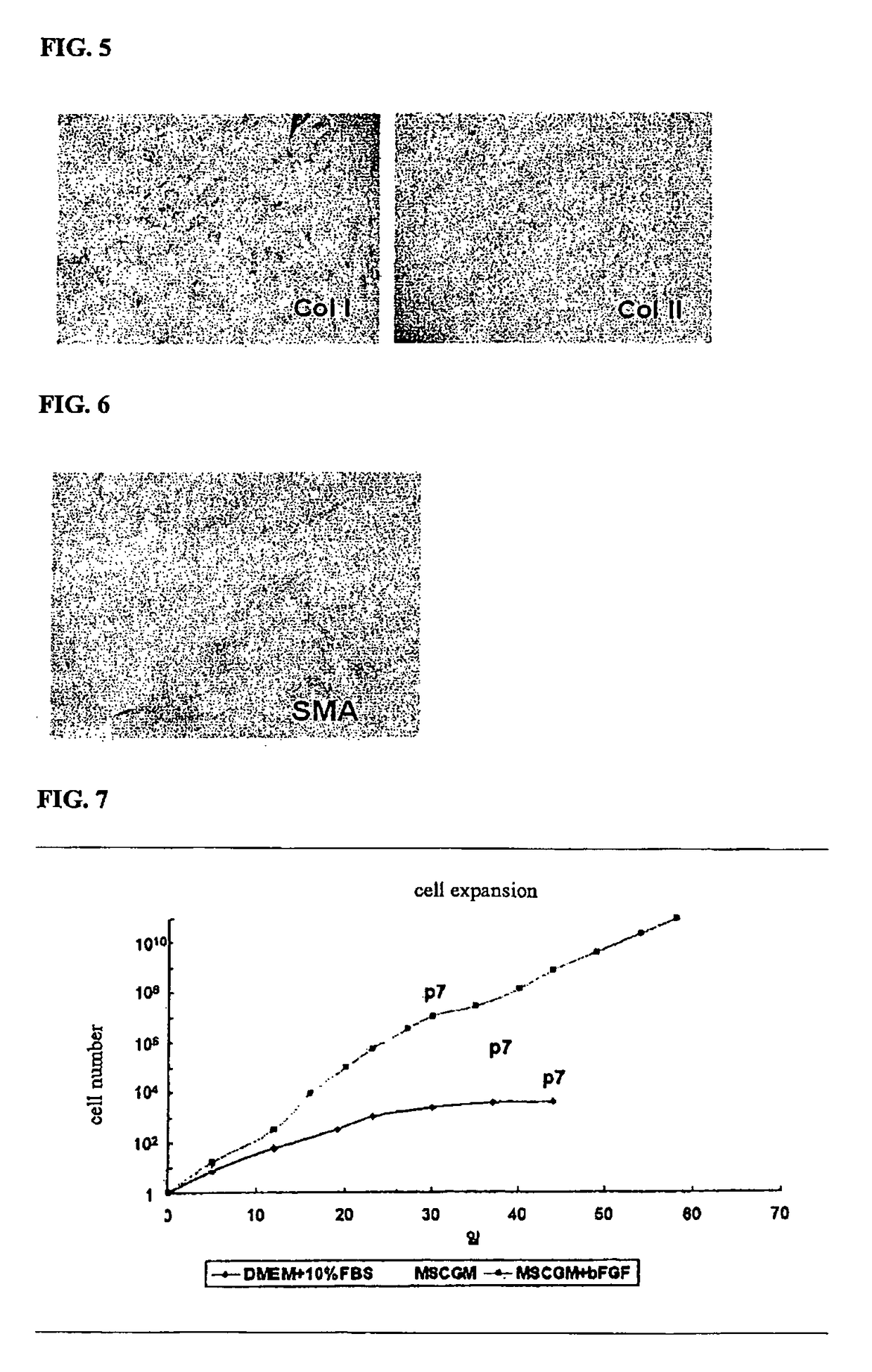 Artificial cartilage containing chondrocytes obtained from costal cartilage and preparation process thereof