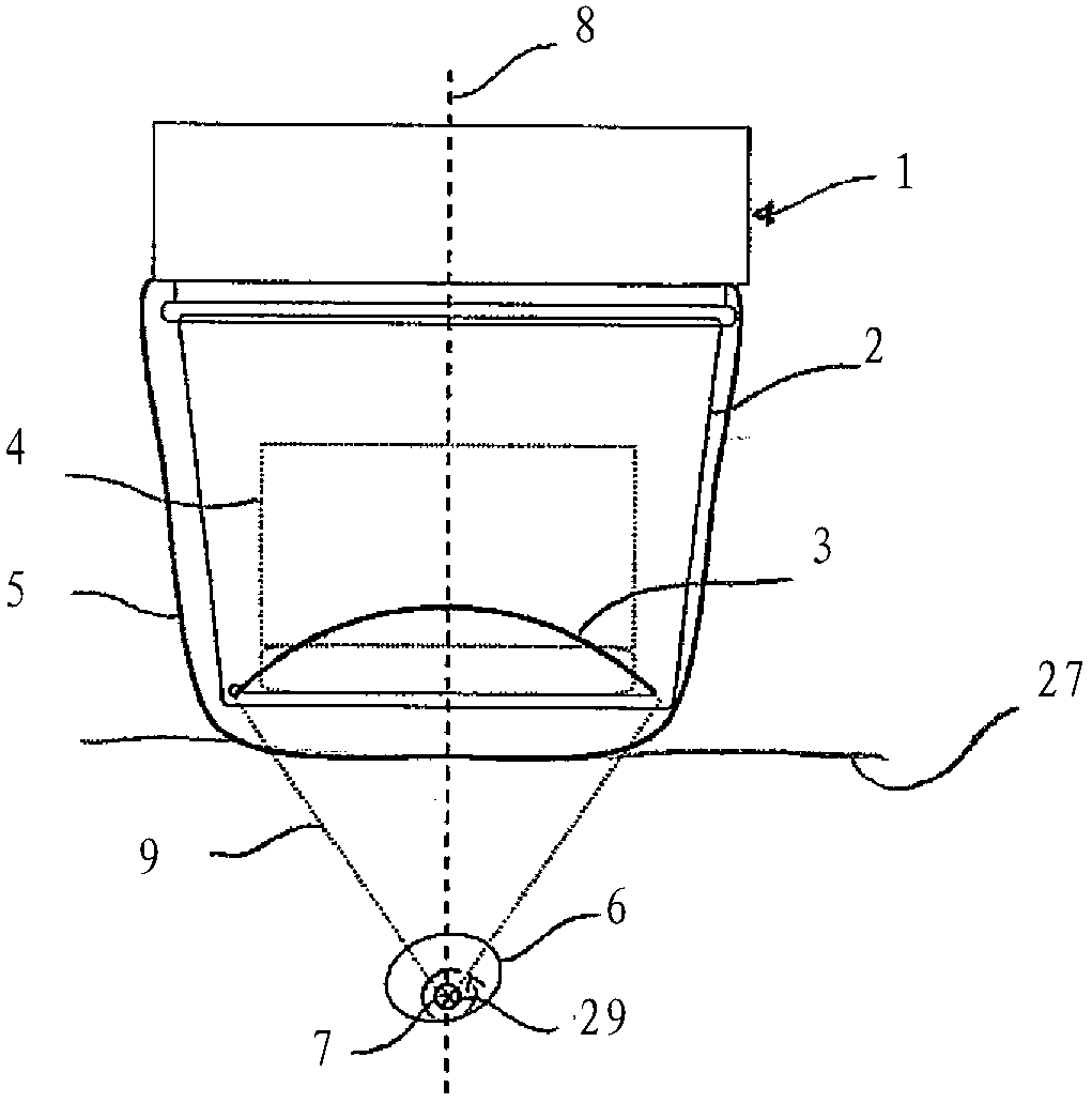 Ultrasound treatment device