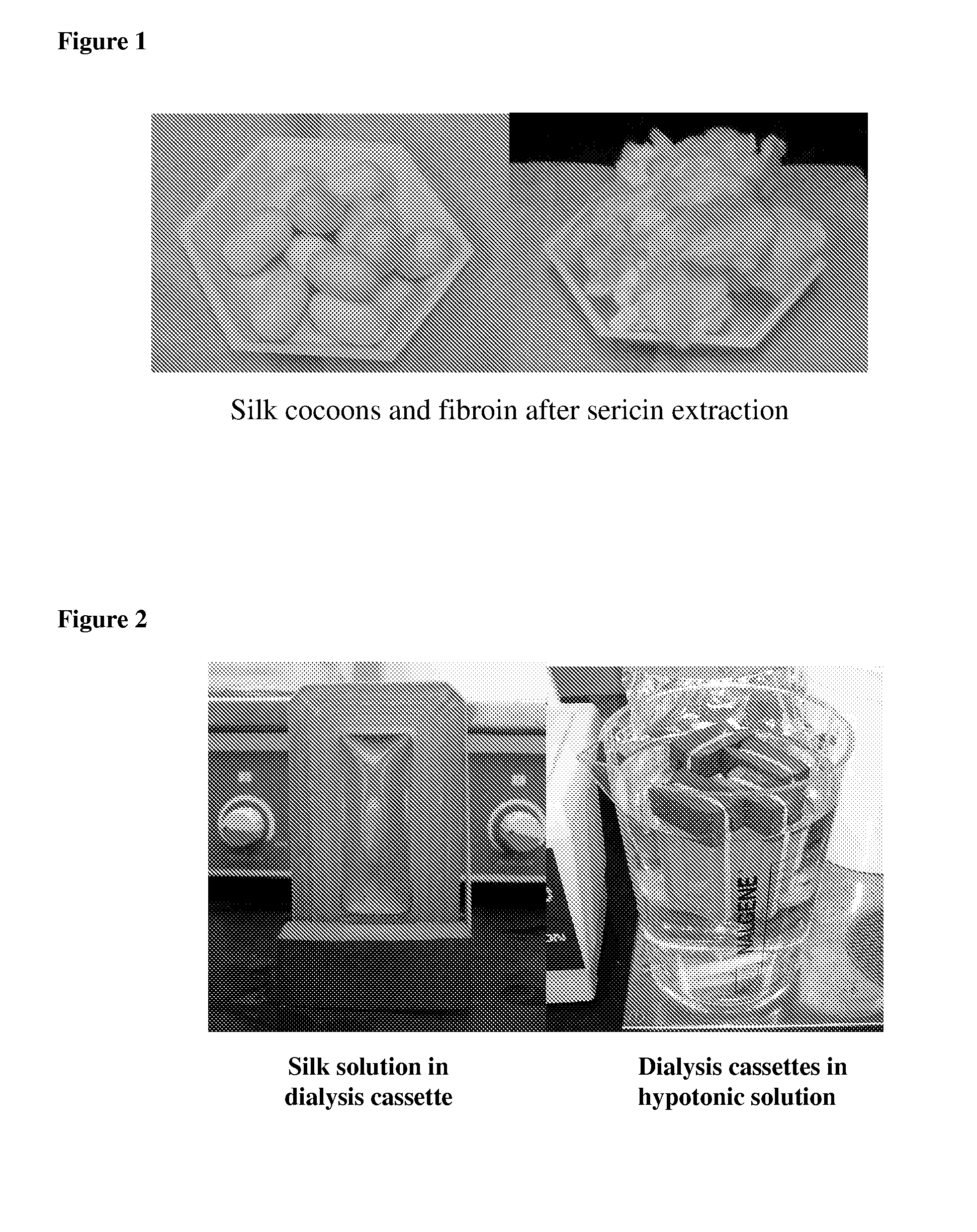 3-dimensional silk hydroxyapatite compositions