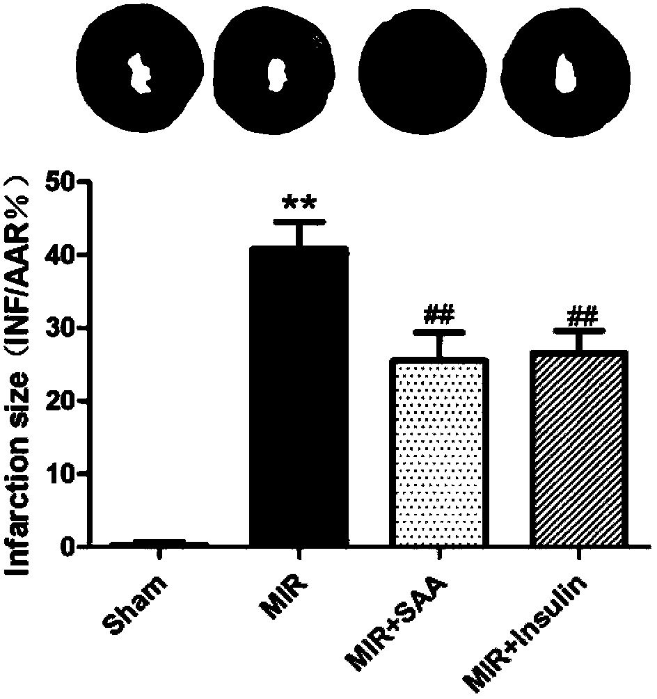 Application of amygdalin in protecting ischemic heart