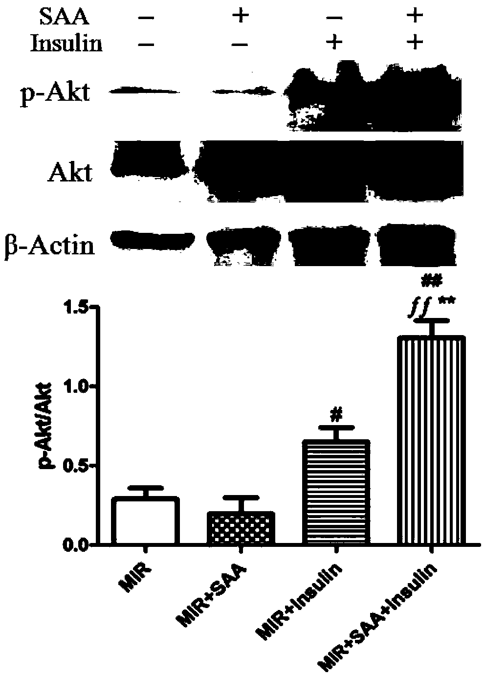 Application of amygdalin in protecting ischemic heart