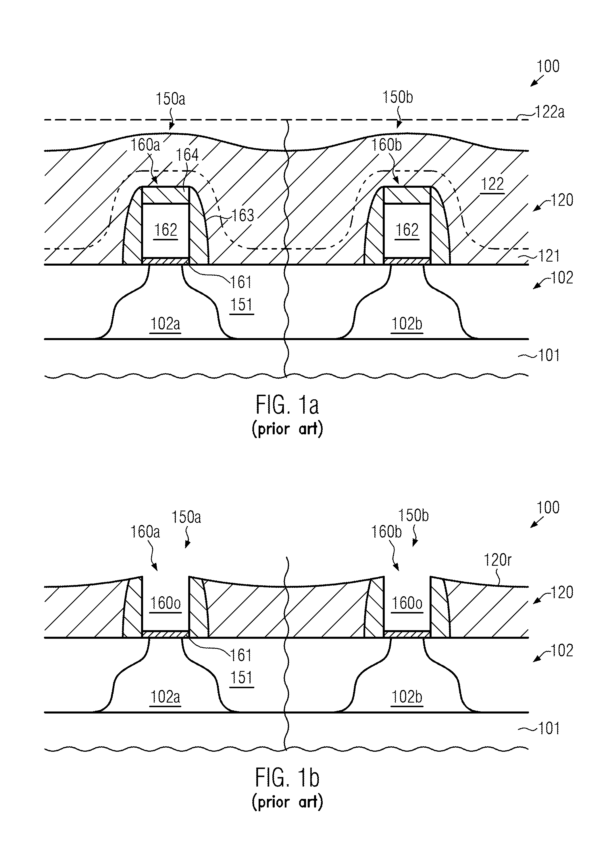 Prevention of ILD Loss in Replacement Gate Technologies by Surface Treatmen