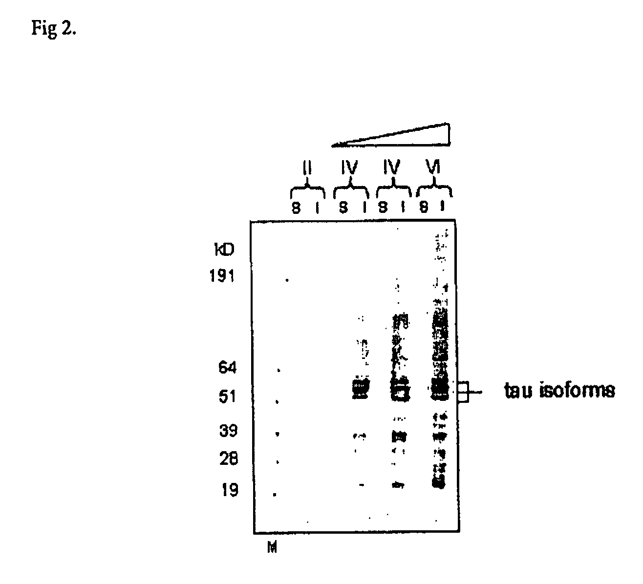 Antibody that recognizes phosphorylated peptides