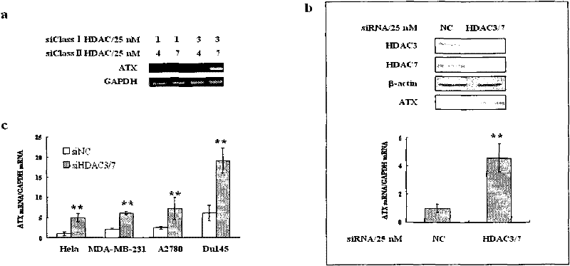 Medicament for treating tumors