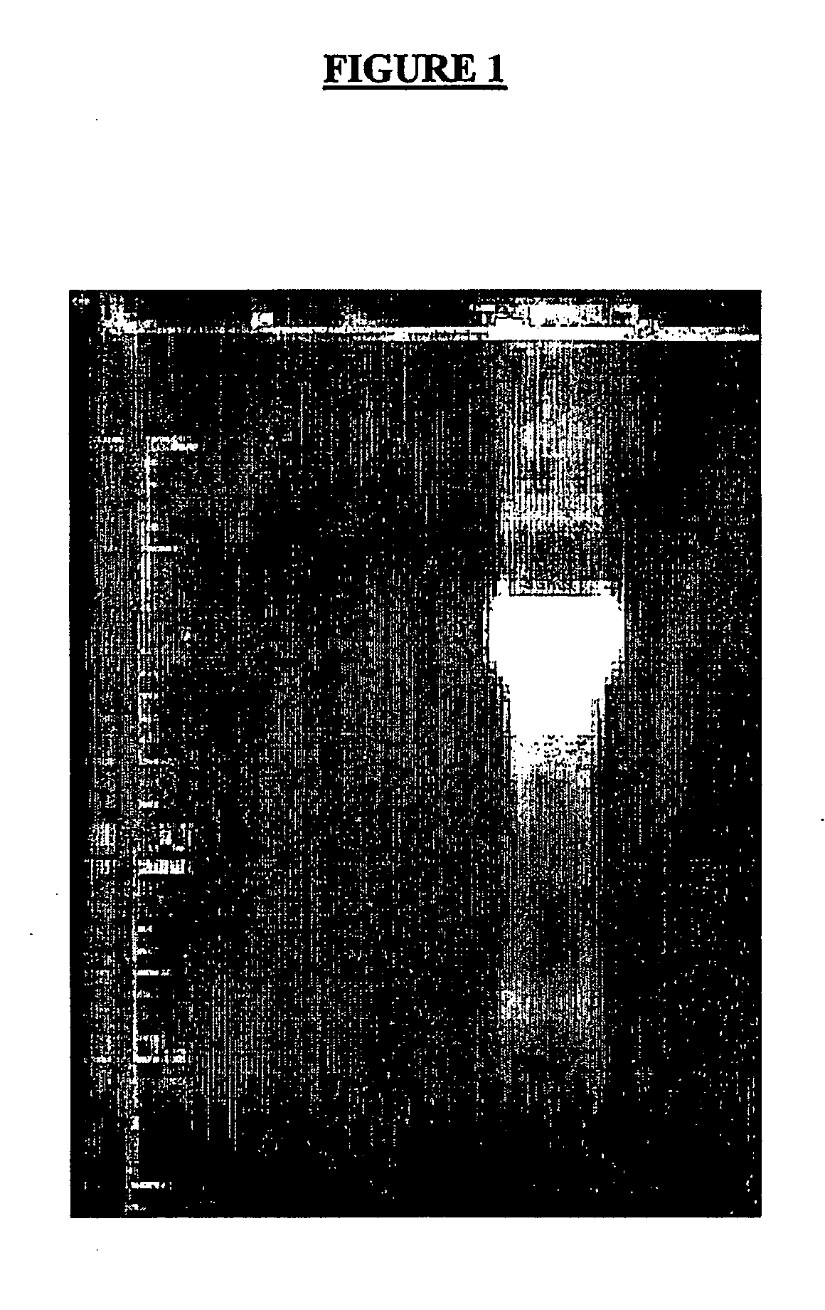 Kunitz-type recombinant inhibitor