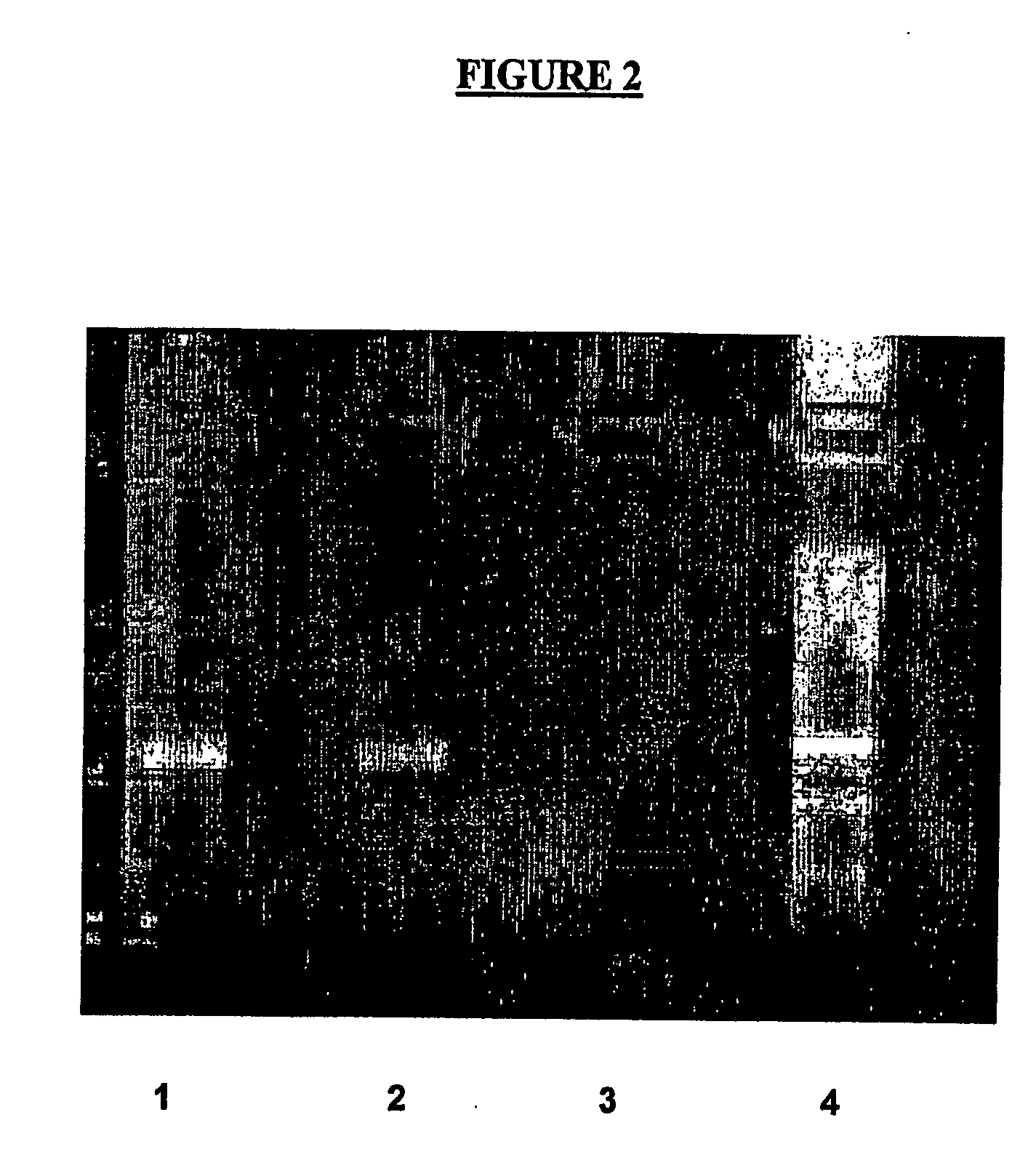 Kunitz-type recombinant inhibitor